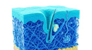 확대된 모공과 피부 진피 구조의 3D 의학 일러스트
